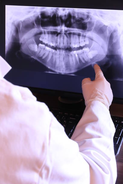 Best Cracked Tooth Emergency Dentist  in Santaquin, UT