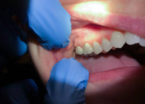 Best Urgent Tooth Repair  in Santaquin, UT
